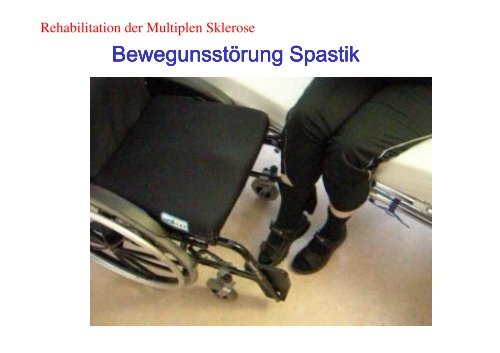 Bernd Anderseck - Multiple Sklerose - AktivitÃ¤t hilf