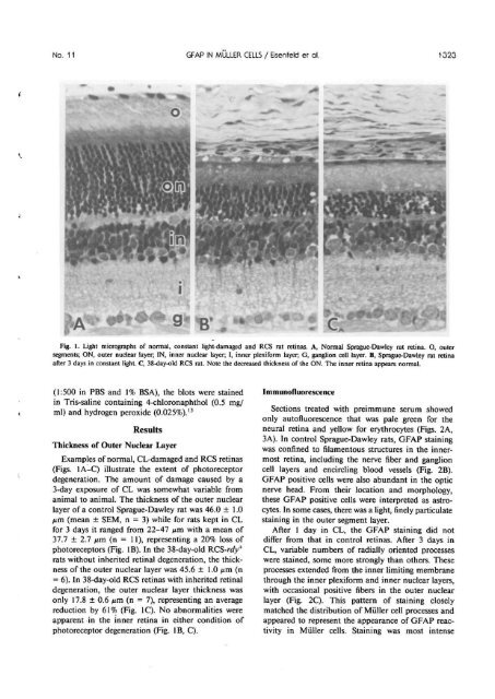 Muller Cell Expression of Gliol Fibrillory Acidic Protein offer Genetic ...