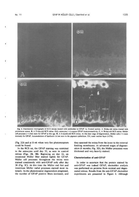 Muller Cell Expression of Gliol Fibrillory Acidic Protein offer Genetic ...