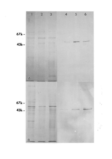 Muller Cell Expression of Gliol Fibrillory Acidic Protein offer Genetic ...