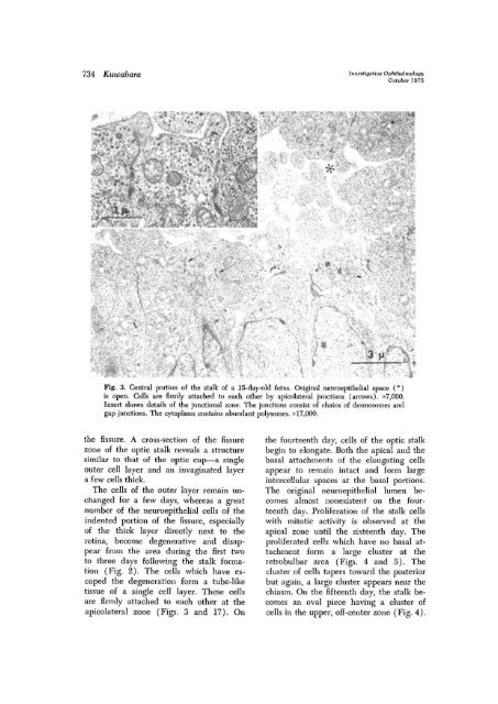 Development of the optic nerve of the rat - Investigative ...