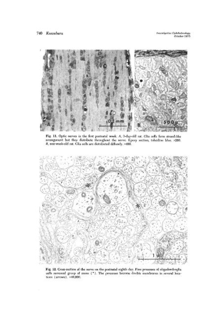 Development of the optic nerve of the rat - Investigative ...