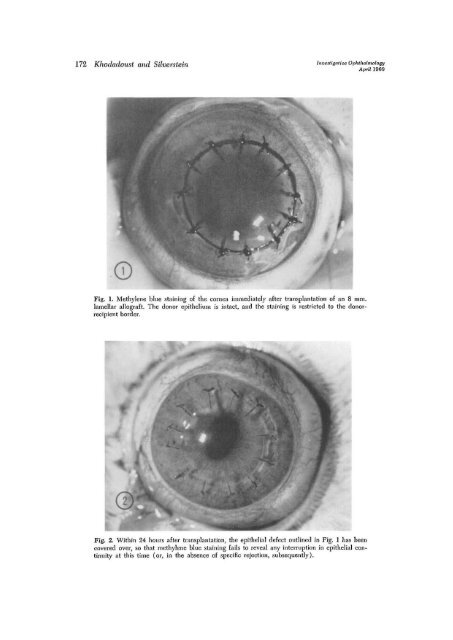 The survival and rejection of epithelium in experimental corneal ...