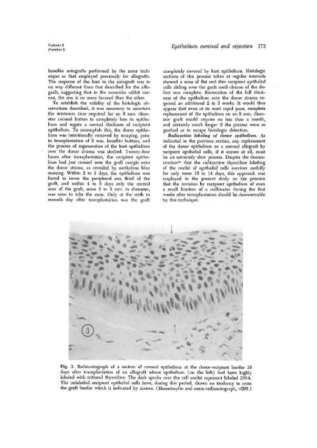 The survival and rejection of epithelium in experimental corneal ...