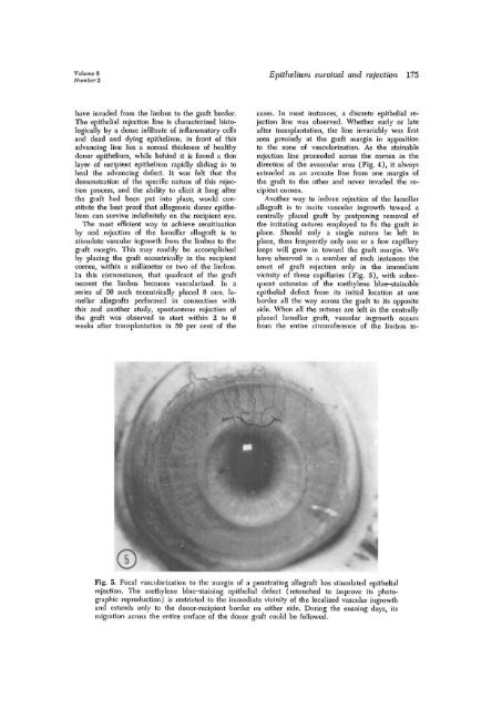 The survival and rejection of epithelium in experimental corneal ...