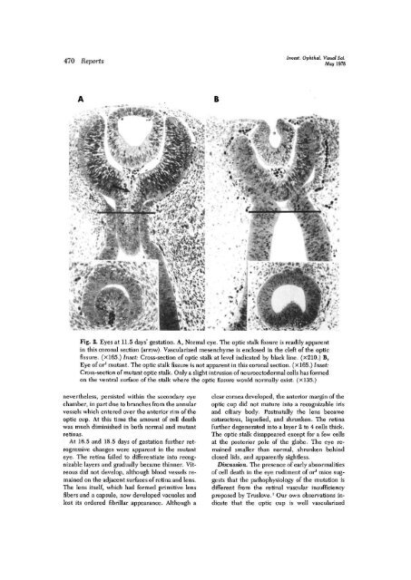 Ocular retardation (or) in the mouse.