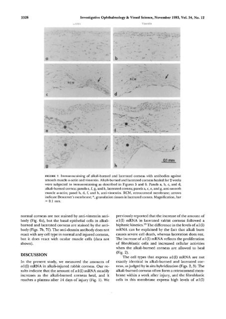 Expression of Collagen I, Smooth Muscle a-Actin, and Vimentin ...