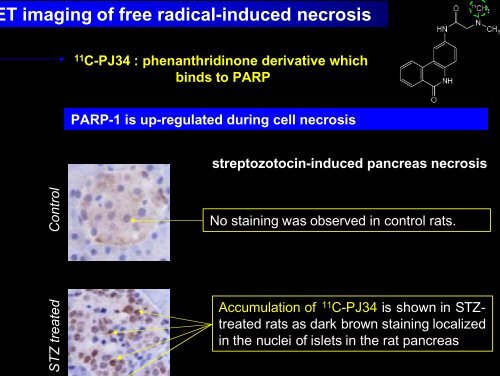 The neurotoxic cascade in the ischemic penumbra