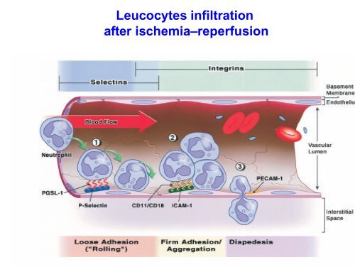 The neurotoxic cascade in the ischemic penumbra