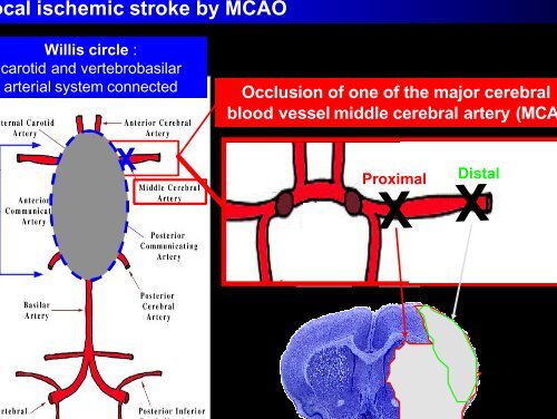 The neurotoxic cascade in the ischemic penumbra