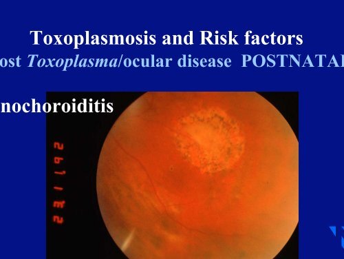 Risk of toxoplasmosis related to foodstuff