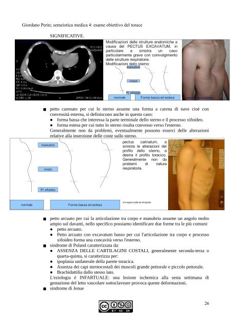 APPUNTI DI SEMEIOTICA - Istituto Comprensivo "G. Palatucci"