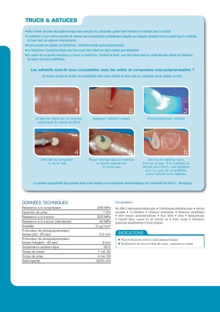 Prevent Seal - Itena clinical France