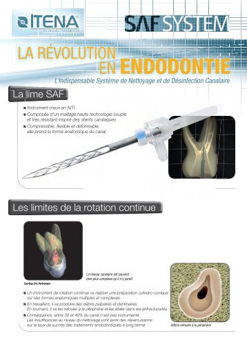 EN ENDODONTIE - Itena clinical France