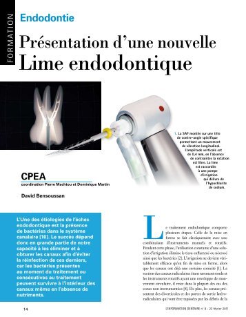 Lime endodontique - Itena clinical France