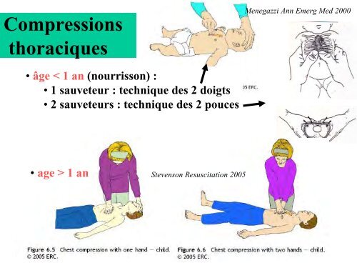 ArrÃªt cardiaque chez l'enfant Jean FranÃ§ois DIEPENDAEL - JLAR