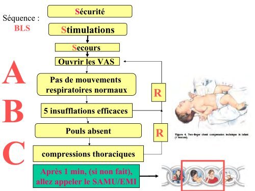 ArrÃªt cardiaque chez l'enfant Jean FranÃ§ois DIEPENDAEL - JLAR