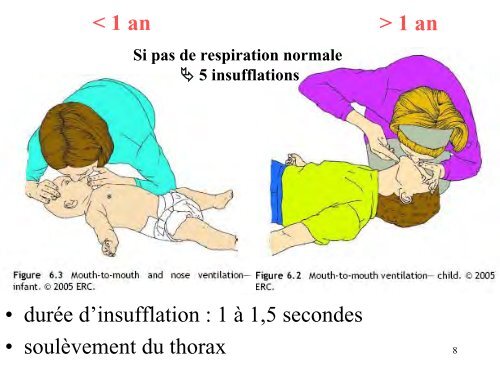 ArrÃªt cardiaque chez l'enfant Jean FranÃ§ois DIEPENDAEL - JLAR