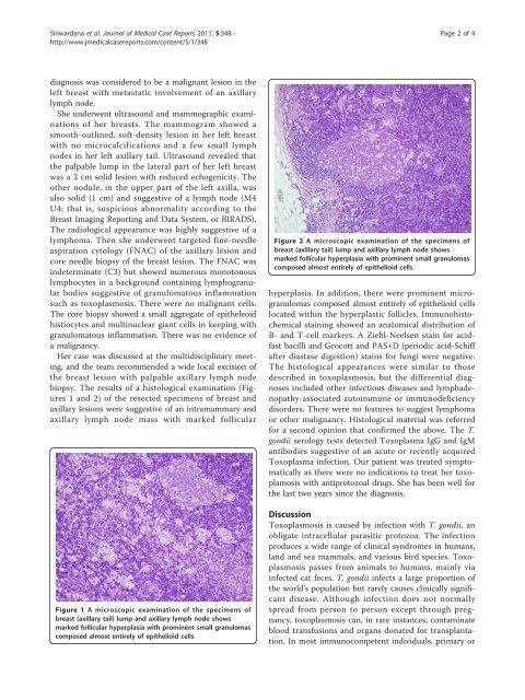 Toxoplasmosis presenting as a swelling in the axillary tail of the ...