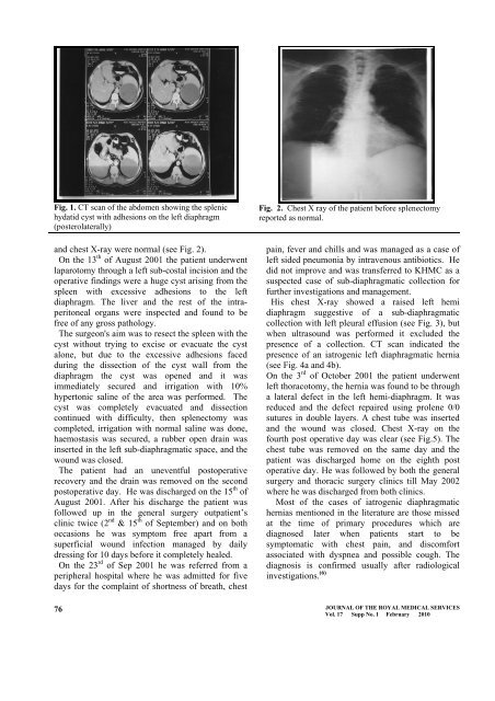 Iatrogenic Left Diaphragmatic Hernia as a Complication of Hydatid ...