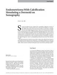 Endometrioma With Calcification Simulating a Dermoid - Journal of ...