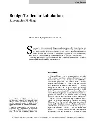 Benign Testicular Lobulation - Journal of Ultrasound in Medicine