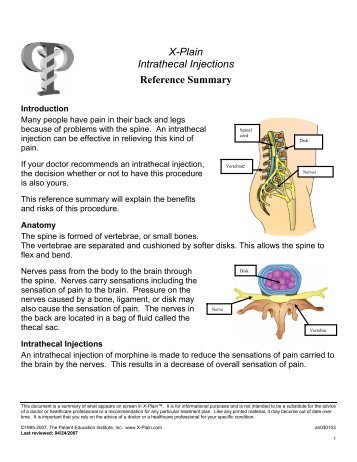 Intrathecal Injections