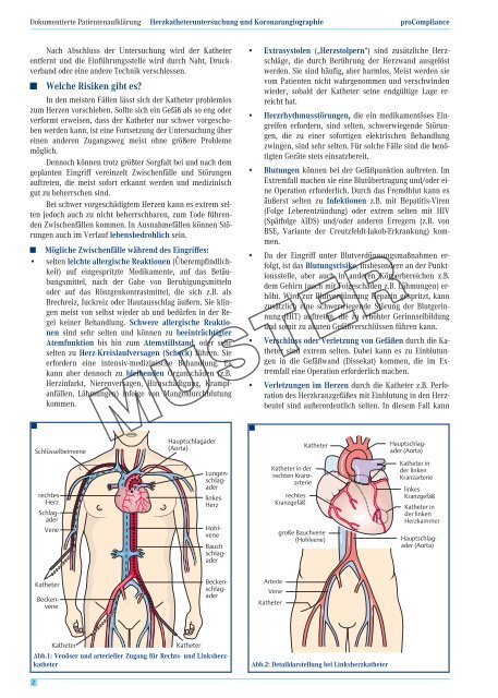 Herzkatheteruntersuchung und Koronarangiographie - Kardiologie ...