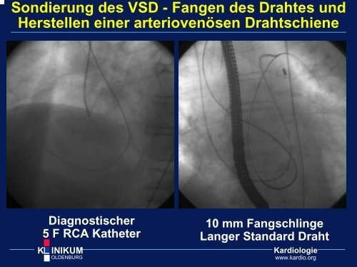 k inikum - Kardiologie Klinikum Oldenburg