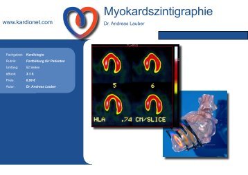 Myokardszintigraphie - Kardionet.com