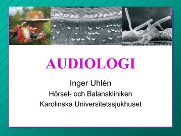 Indelning av hörselskador