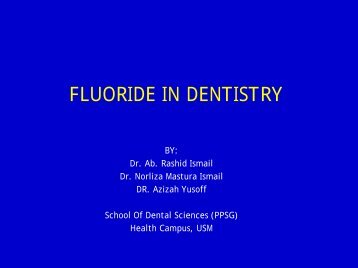 fluoride in dentistry - usm