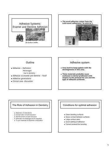 Adhesion Systems Enamel and Dentine Adhesion