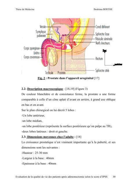 titre evaluation de la qualite de vie des patients apres ...