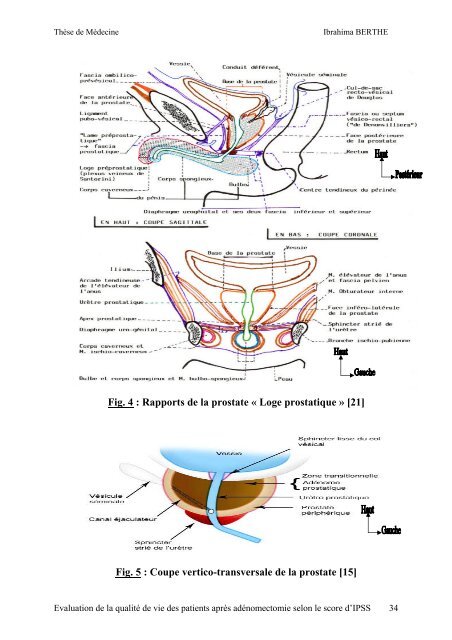 titre evaluation de la qualite de vie des patients apres ...