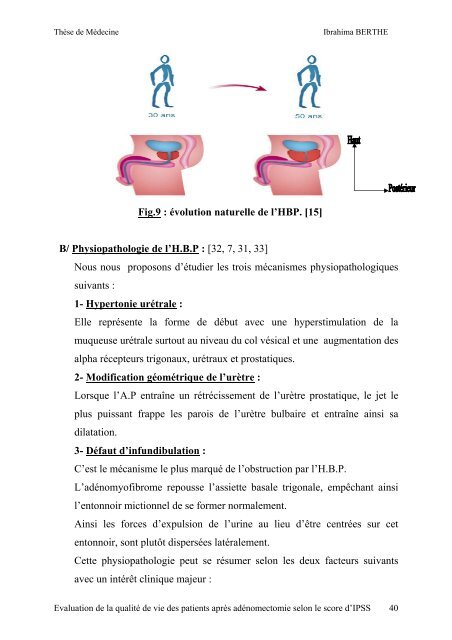 titre evaluation de la qualite de vie des patients apres ...