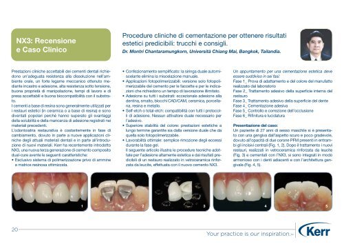 Guida Clinica alla Cementazione - Kerr