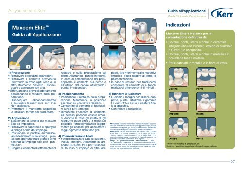 Guida Clinica alla Cementazione - Kerr