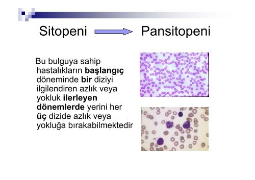 Pansitopeni ve ateÅ - Klimik