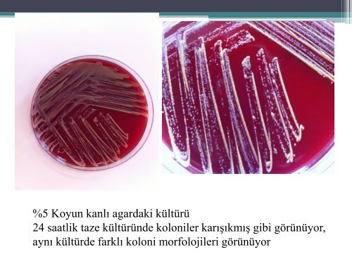 Nocardia spp - Klimik