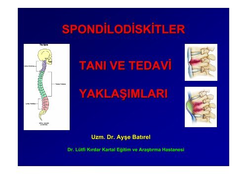 Spondilodiskitler ve Protez Ä°nfeksiyonlarÄ±na YaklaÅÄ±m - Klimik