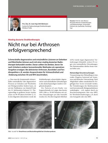 Nicht nur bei Arthrosen erfolgversprechend - Klinikum Fulda