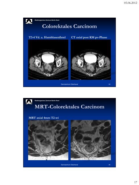 MRT in der Diagnostik und prognostischen Aussage