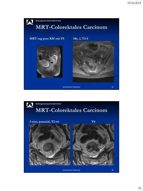 MRT in der Diagnostik und prognostischen Aussage