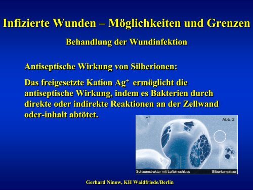 Infizierte Wunden – Möglichkeiten und Grenzen Infizierte Wunden ...