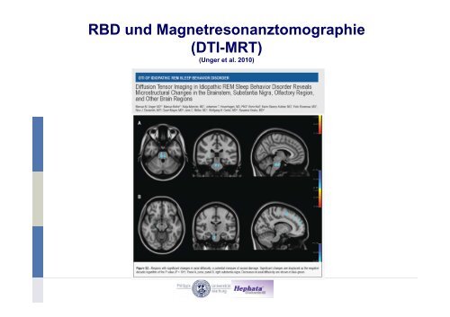 RBD-Studien und Meilensteine - Kompetenznetz Parkinson