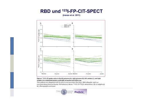 RBD-Studien und Meilensteine - Kompetenznetz Parkinson