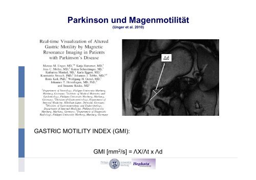 RBD-Studien und Meilensteine - Kompetenznetz Parkinson