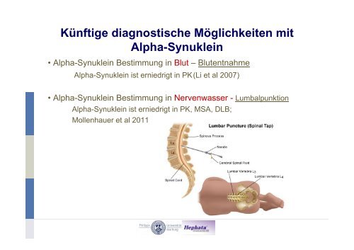 RBD-Studien und Meilensteine - Kompetenznetz Parkinson