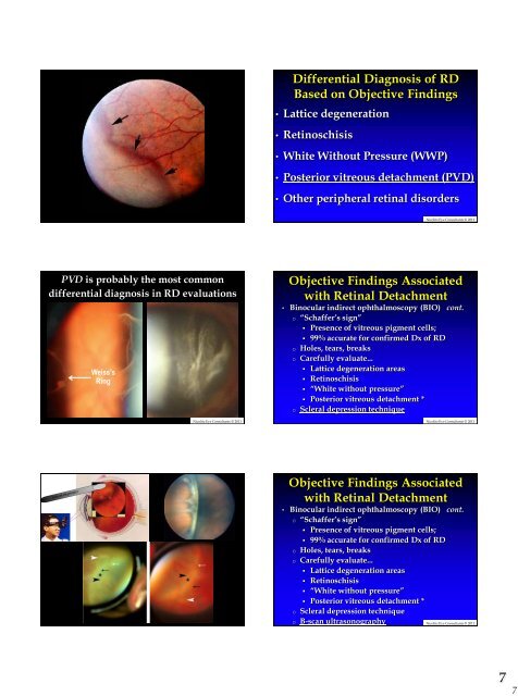 Retinal Detachment - Kontaktlinse Instituttet